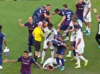 Σοκαριστικός τραυματισμός για πρώην παίκτη του ΠΑΟΚ (ΒΙΝΤΕΟ)